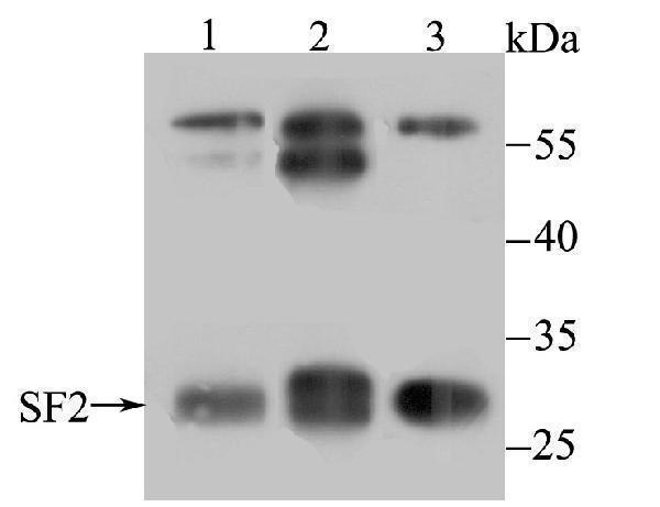 a00497 srsf1 primary antiboties wb testing 1
