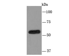 Western blot analysis of Cytochrome P450 2D6 on HepG2 cell using anti-Cytochrome P450 2D6 antibody at 1/1,000 dilution