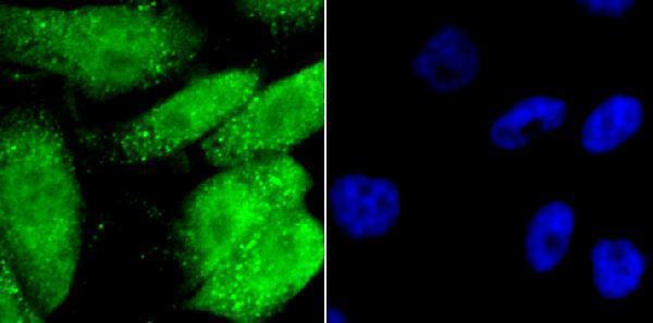 ICC staining GATA4 in PC-3M cells (Green)