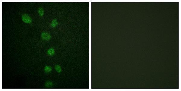 Immunofluorescence analysis of HepG2 cells, using GATA4 (Phospho-Ser105) Antibody