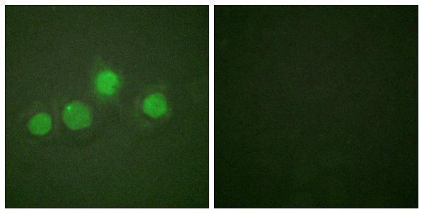 Immunofluorescence analysis of HUVEC cells, using GATA4 (Phospho-Ser262) Antibody