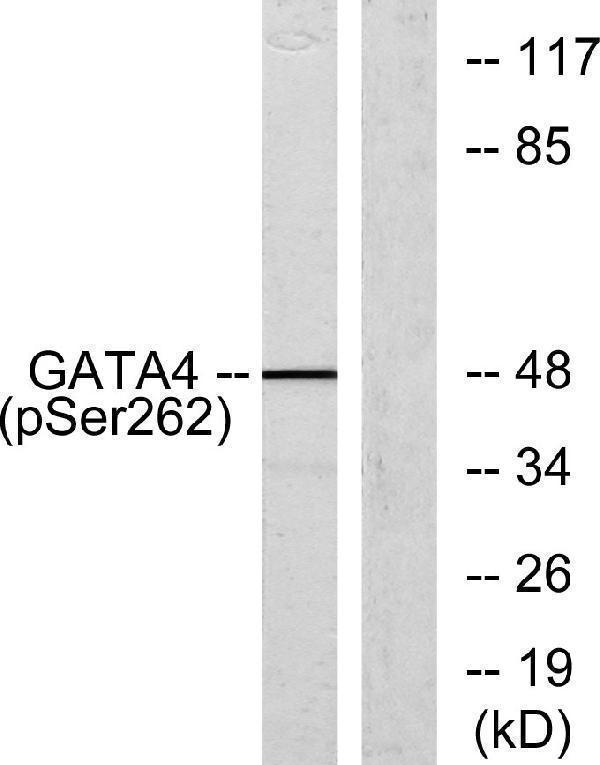 Western blot analysis of lysates from 293 cells, using GATA4 (Phospho-Ser262) Antibody