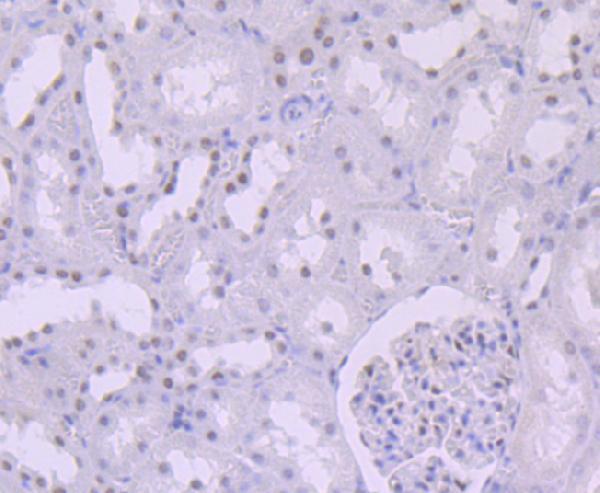 a00500 1 smarcb1 primary antiboties ihc testing 2