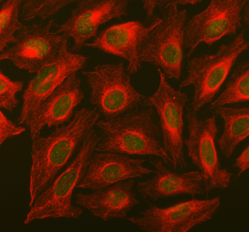a00500 2 smarcb1 primary antibodies if testing 1