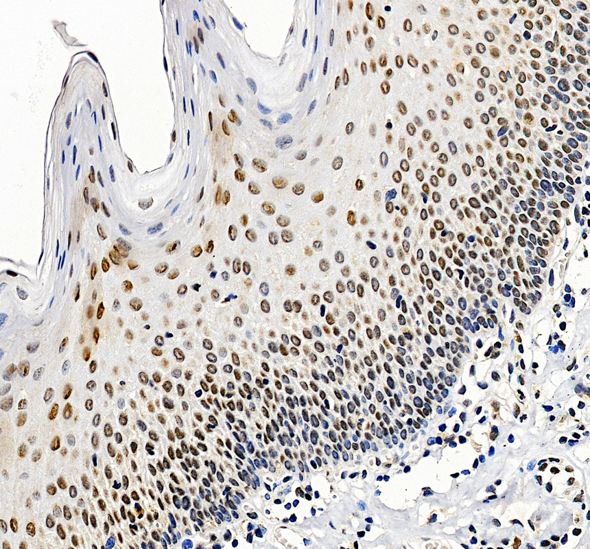 a00500 2 smarcb1 primary antibodies ihc testing 1
