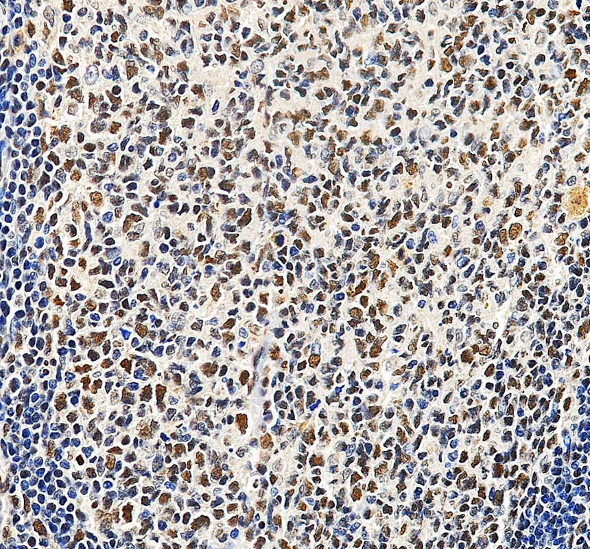 a00500 2 smarcb1 primary antibodies ihc testing 2