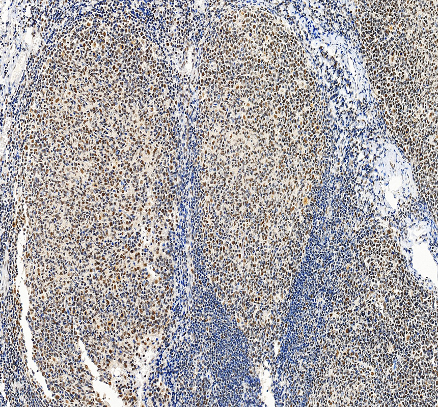 a00500 2 smarcb1 primary antibodies ihc testing 3