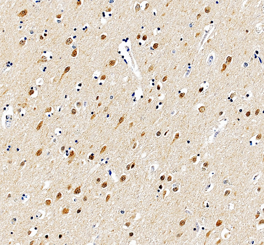 a00500 2 smarcb1 primary antibodies ihc testing 4