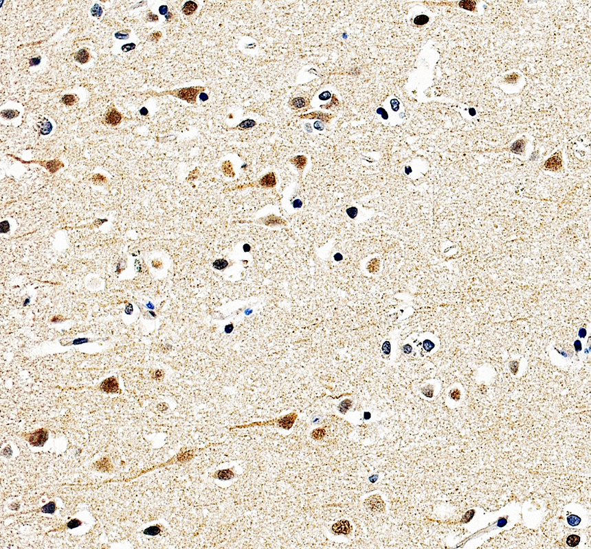 a00500 2 smarcb1 primary antibodies ihc testing 5