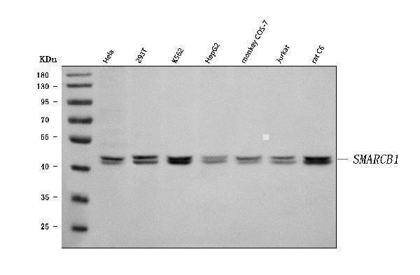  Western blot analysis of SNF5/SMARCB1 using anti-SNF5/SMARCB1 antibody (A00500-2)