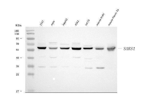 a00501 1 sars1 primary antibodies wb testing 1