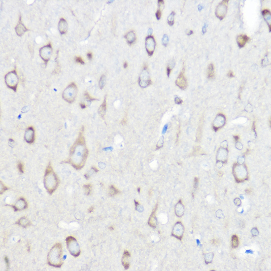 a00501 sars primary antiboties ihc testing 2