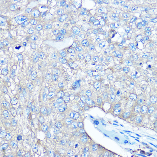 a00501 sars primary antiboties ihc testing 3