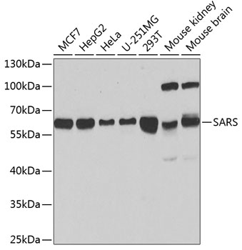 a00501 sars primary antiboties wb testing 1