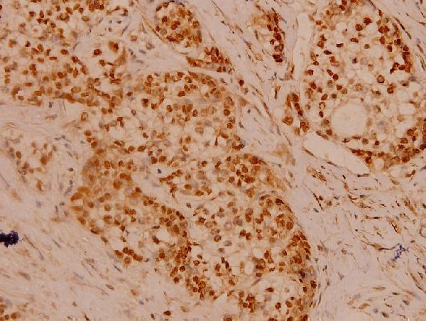 a00502 2 flna primary antiboties ihc testing 2