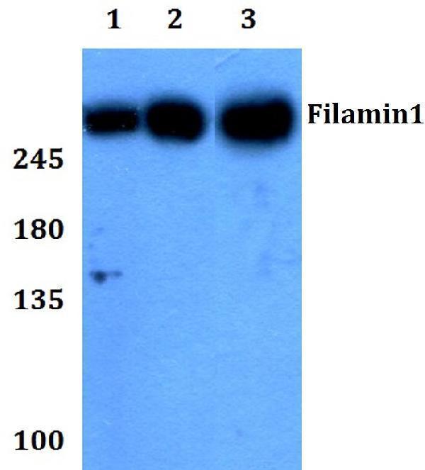 a00502 2 flna primary antiboties wb testing 1