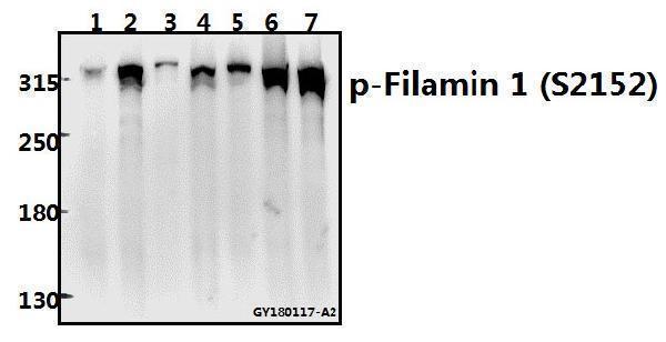 Western blot (WB) analysis of Filamin 1 (phospho-S2152) polyclonal antibody at 1:500 dilution
Lane1:Hela whole cell lysate(40ug)
Lane2:A549 whole cell lysate(20ug)
Lane3:The Lung tissue lysate of Rat(20ug)
Lane4:AML-12 whole cell lysate(40ug)
Lane5:CT26 whole cell lysate(40ug)
Lane6:SKOVCAR3 whole cell lysate(40ug)
Lane7:Panc1 whole cell lysate(40ug)