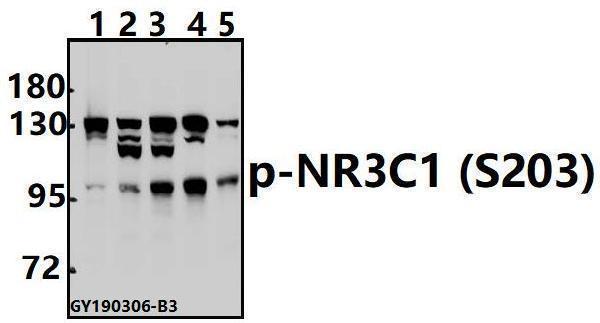 Western blot (WB) analysis of NR3C1 (Phospho-S203) polyclonal antibody at 1:500 dilution
Lane1:Hela whole cell lysate(40ug)
Lane2:A375 whole cell lysate(40ug)
Lane3:L02 whole cell lysate(40ug)
Lane4:AML-12 whole cell lysate(40ug)
Lane5:PMVEC whole cell lysate(40ug)