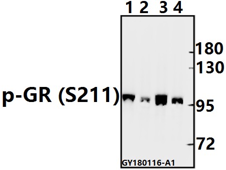 Western blot (WB) analysis of p-GR (S211) pAb at 1:500 dilution
Lane1:SK-OVCAR3 whole cell lysate(40ug)
Lane2:PC12 whole cell lysate(40ug)
Lane3:CT26 whole cell lysate(40ug)
Lane4:SGC7901 whole cell lysate(40ug)