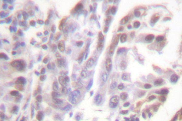 a00503s226 nr3c1 primary antiboties ihc testing 2