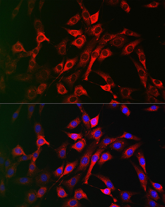 Immunofluorescence analysis of NIH/3T3 cells using LRP5 pAb at dilution of 1:200 (40x lens)