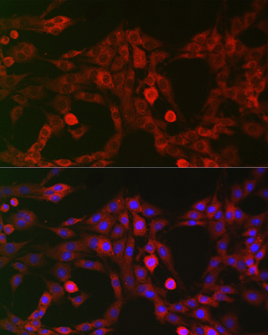 Immunofluorescence analysis of PC12 cells using LRP5 pAb at dilution of 1:200 (40x lens)