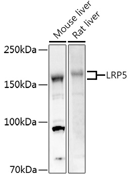 Western blot analysis of extracts of various cell lines, using LRP5 antibody at 1:500 dilution