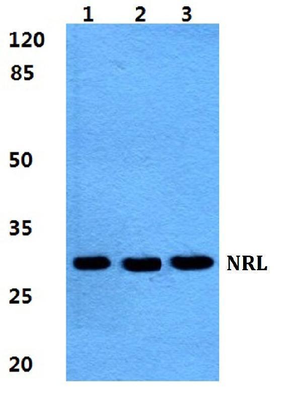 Western blot (WB) analysis of NRL polyclonal antibody at 1:500 dilution
Lane1:HEK293T cell lysate
Lane2:sp2/0 cell lysate
Lane3:PC12 cell lysate