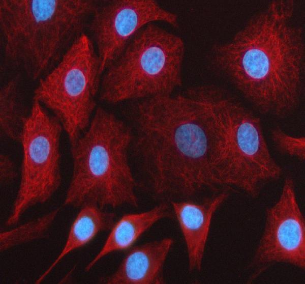a00506 1 hfe primary antibodies if testing 1