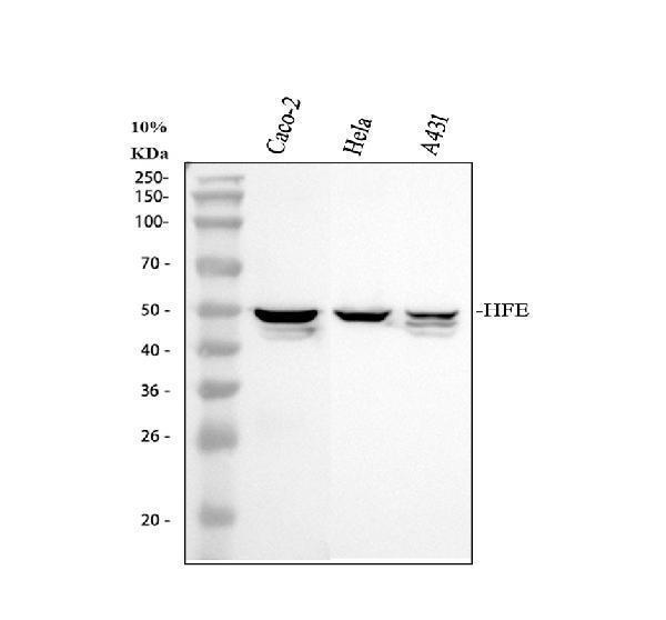 Western blot analysis of HFE using anti-HFE antibody (A00506-1)