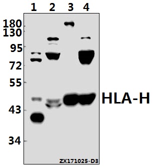 Western blot (WB) analysis of HLA-H (I104) pAb at 1:1000 dilution
Lane1:Hela whole cell lysate(10ug)
Lane2:H1792 whole cell lysate(40ug)
Lane3:The Heart tissue lysate of Mouse(40ug)
Lane4:The Heart tissue lysate of Rat(40ug)