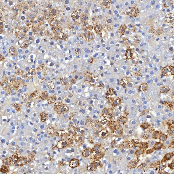a00506 5 hfe primary antibodies ihc testing 2