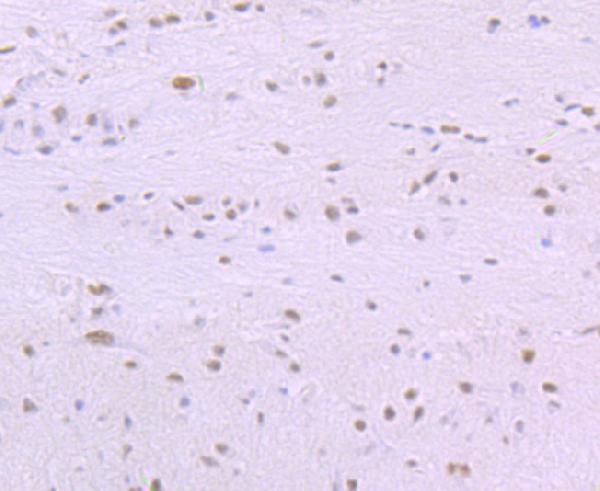 a00507 1 sf3b1 primary antiboties ihc testing 2