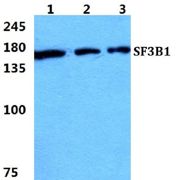 a00507 sf3b1 primary antiboties wb testing 1