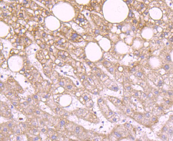 a00510 1 idh2 primary antiboties ihc testing 2