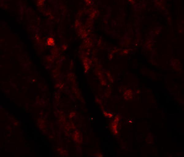 Immunofluorescence of IDH2 in mouse heart tissue with IDH2 antibody at 20 μg/mL