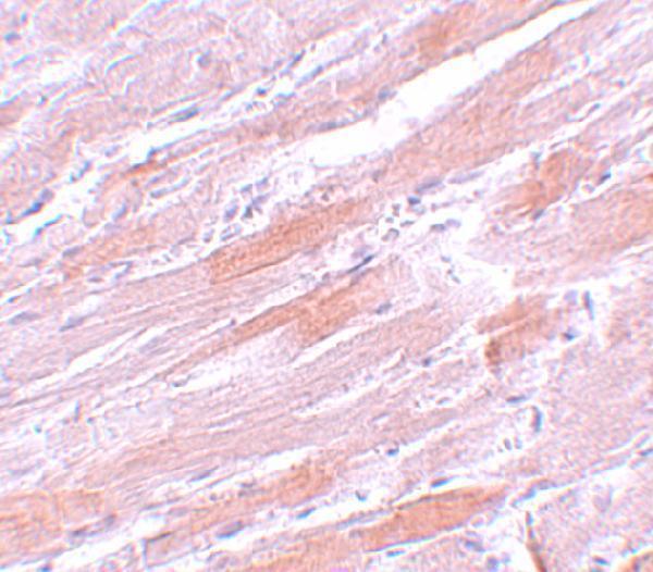 Immunohistochemistry of IDH2 in mouse heart tissue with IDH2 antibody at 5 μg/mL