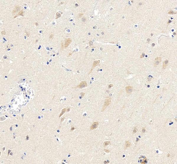IHC analysis of CDK5 using anti-CDK5 antibody (A00511-1)