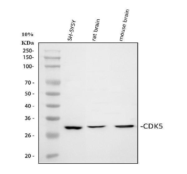  Western blot analysis of CDK5 using anti-CDK5 antibody (A00511-1)