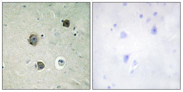 a00511 2 cdk5 primary antibodies ihc testing 1