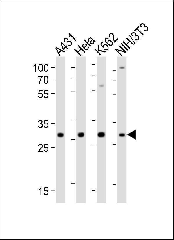 Western blot analysis of lysates from A431, Hela, K562, mouse NIH/3T3 cell line (from left to right), using CDK5 Antibody (C-term)