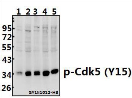 Western blot (WB) analysis of Cdk5 (phospho-Y15) polyclonal antibody at 1:500 dilution
Lane1:U-87MG whole cell lysate(40ug)
Lane2:A2780 whole cell lysate(40ug)
Lane3:SK-OVCAR3 whole cell lysate(40ug)
Lane4:C6 whole cell lysate(40ug)
Lane5:BV2 whole cell lysate(40ug)