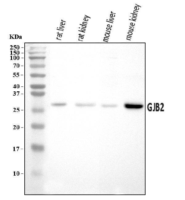  Western blot analysis of GJB2 using anti-GJB2 antibody (A00512-1)