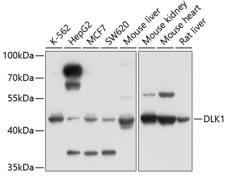 Western blot analysis of extracts of various cell lines, using DLK1 antibody  at 1:1000 dilution
