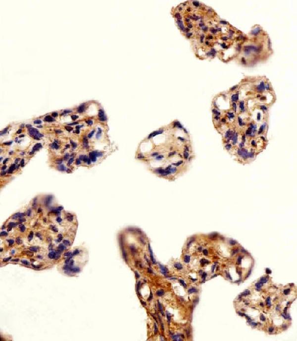 a00513 3 anti dlk1 antibody c term ihc p testing 2