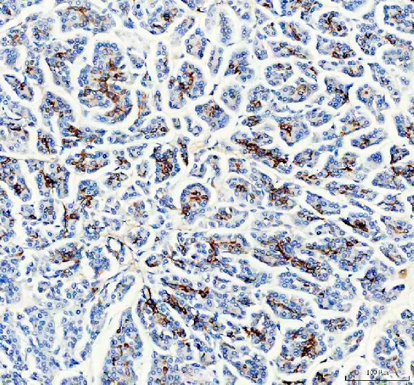 IHC analysis of DLK-1/DLK1 using anti-DLK-1/DLK1 antibody (A00513-5)