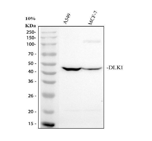 Western blot analysis of DLK-1/DLK1 using anti-DLK-1/DLK1 antibody (A00513-5)