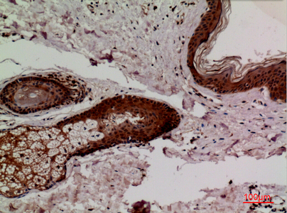Immunohistochemistry validation of KEAP1 using Anti-Keap1 Antibody (A00514-2)