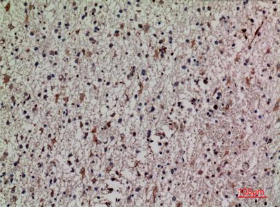 a00514 2 keap1 primary antibodyes ihc testing 4