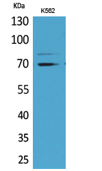 Western blotting validation for Anti-Keap1 Antibody A00514-2
Western Blot (WB) analysis of K562 cells using Keap1 polyclonal antibody